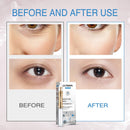 VisionSkin™ 3D - Creme Revitalizador de Olhos 6 Em 1